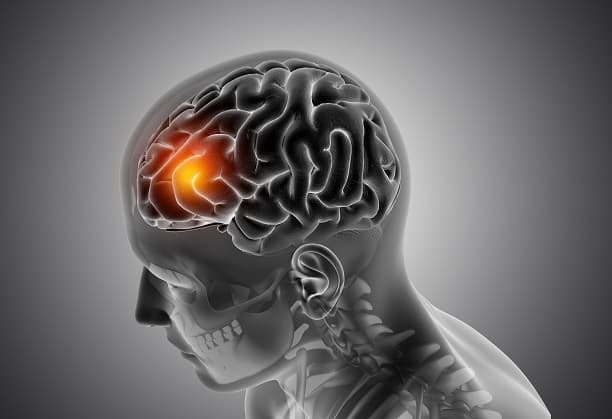 Targeting chemotherapy-resistant aggressive recurrent glioblastoma using soft hydrogel biomaterials