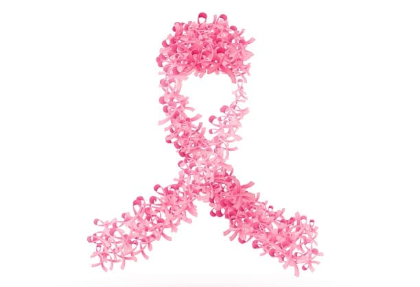 CSR Proposal on Breast Cancer Genomics