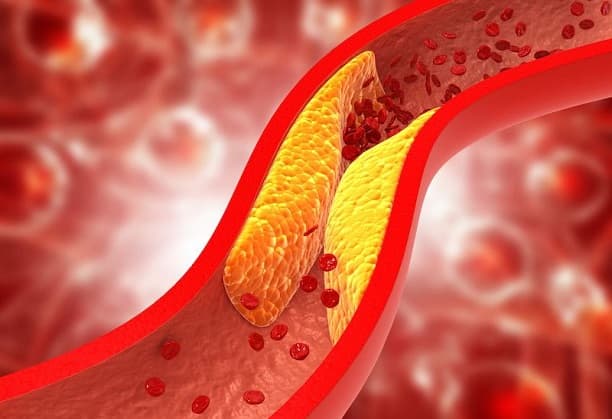Evaluation of Ribonucleic Acid as a Novel Cholesterol-lowering Agent