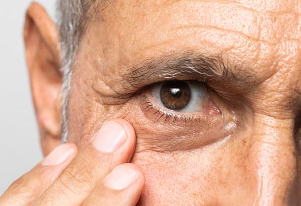 Advancing public health through affordable glaucoma screening systems (Concept Note)