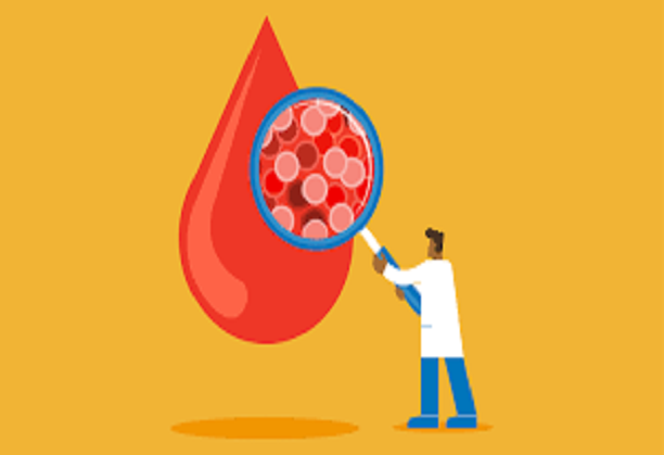 Development of a multiplexed aptamer-based diagnosis kit for early detection of SEPSIS using smart biosensing