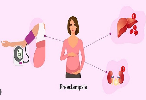 Developing protein biomarkers for late-onset preeclampsia for risk assessment, early detection and personalised management strategies