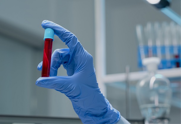 Design and development of high precision, affordable devices for ultra purification of blood (Broken down into smaller proposal as per our feedback)